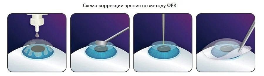 схема коррекции ФРК